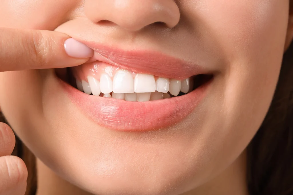 Primo piano dei denti umani, per mostrare che l’uomo non nasce carnivoro ma ha denti adatti a una dieta vegetale