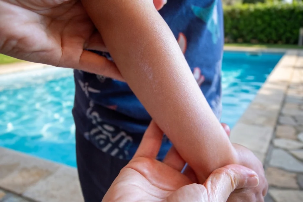Braccio di un bambino a bordo piscina dopo l'applicazione della Crema Spray Solare SPF 50+ Baby, che mostra la pelle idratata e senza residui bianchi